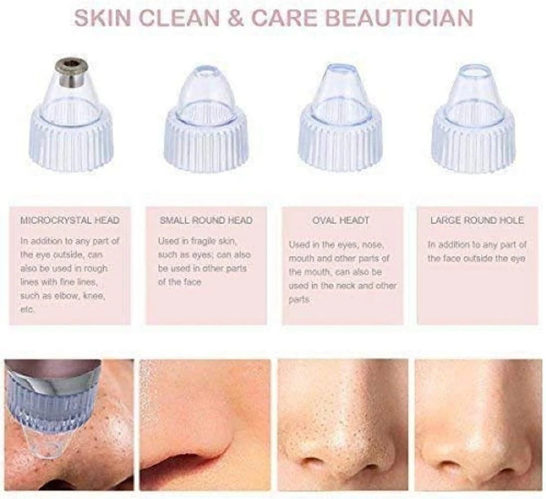 Rechargeable Pre Cleaning Device - Blackhead Remover Vacuum